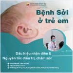 Bệnh sởi ở trẻ em – Dấu hiệu nhận diện & một số nguyên tắc cần lưu ý