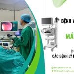 Bệnh viện Bình An đầu tư máy nội soi EP-6000 – Hỗ trợ tầm soát các bệnh lý đường tiêu hoá