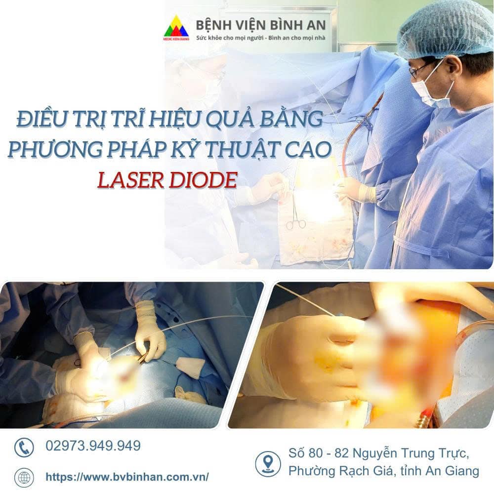 Điều trị trĩ hiệu quả bằng phương pháp kỹ thuật cao Laser Diode – Xoá đi nỗi lo cắt trĩ bằng phương pháp truyền thống